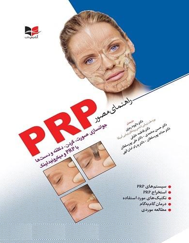 کتاب راهنمای مصور PRP