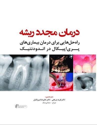 کتاب درمان مجدد ریشه