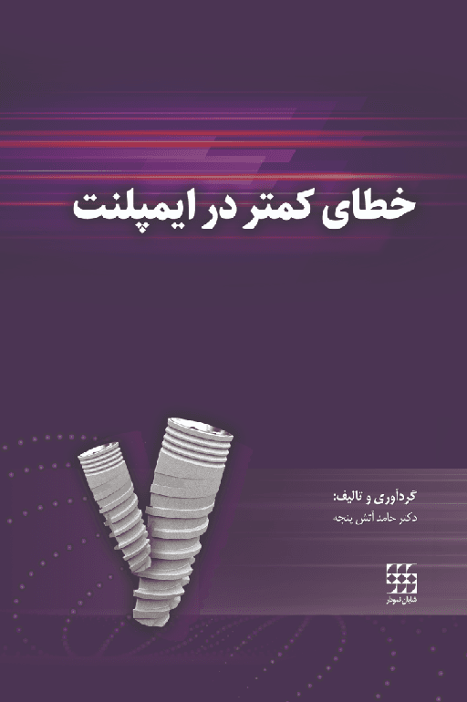 کتاب خطای کمتر در ایمپلنت