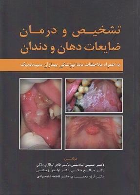کتاب تشخیص و درمان ضایعات دهان و دندان